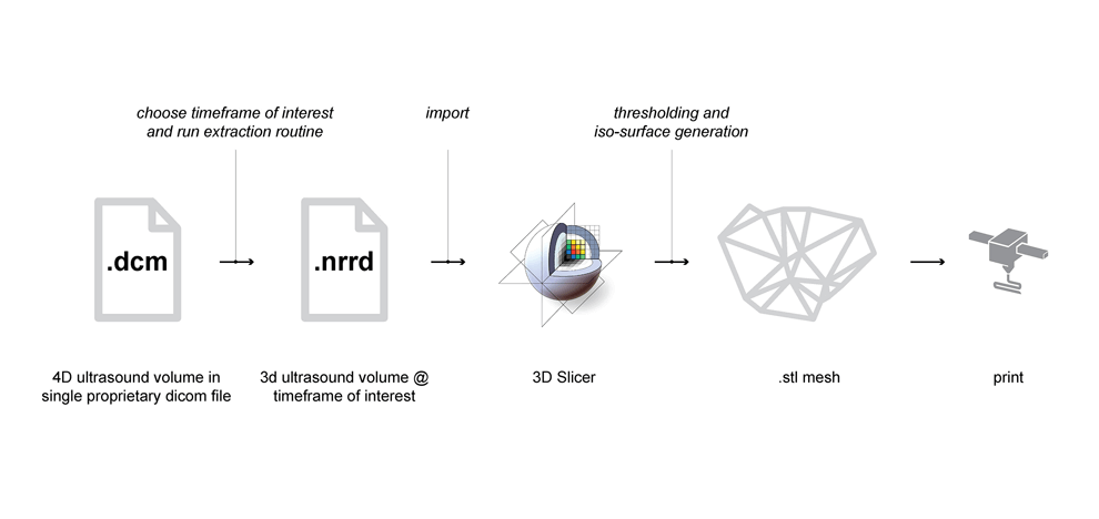 unlocking-vendor-specific-tags-three-dimensional-printing-echocardiography-data-sets-1